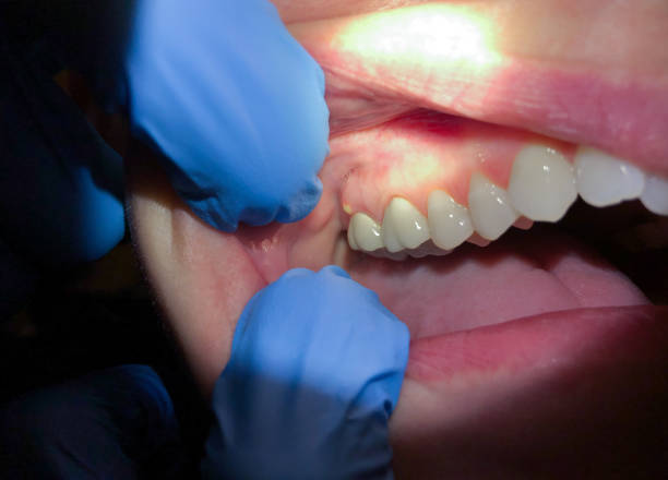 Best Emergency Cosmetic Dentistry in Gulfport, MS